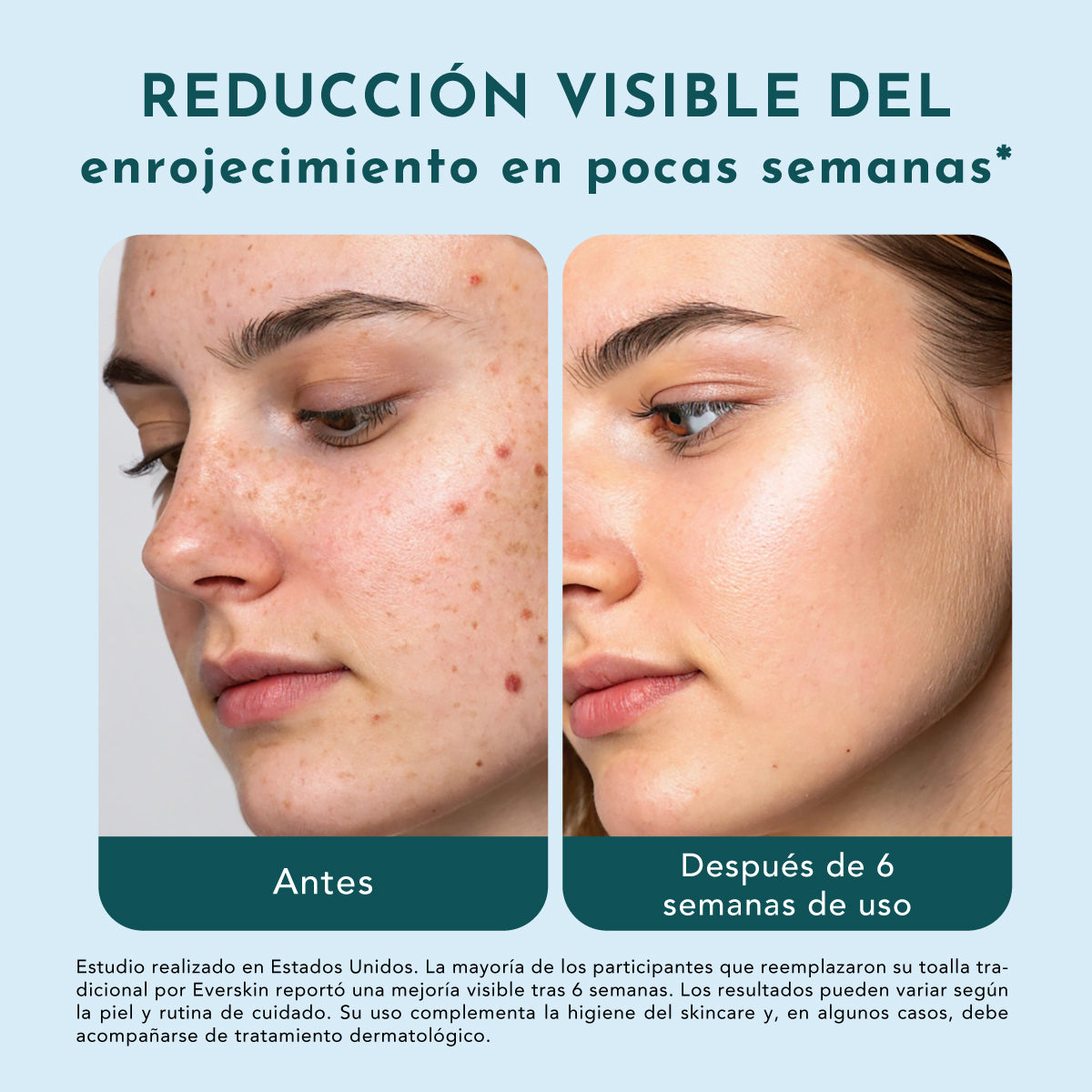 Toallas Faciales Everskin XL 50 Unidades